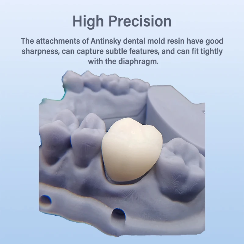 Lodden 3D プリンタ樹脂液体 385/405nm 高 - 3D Printing Xyz のレビューと価格